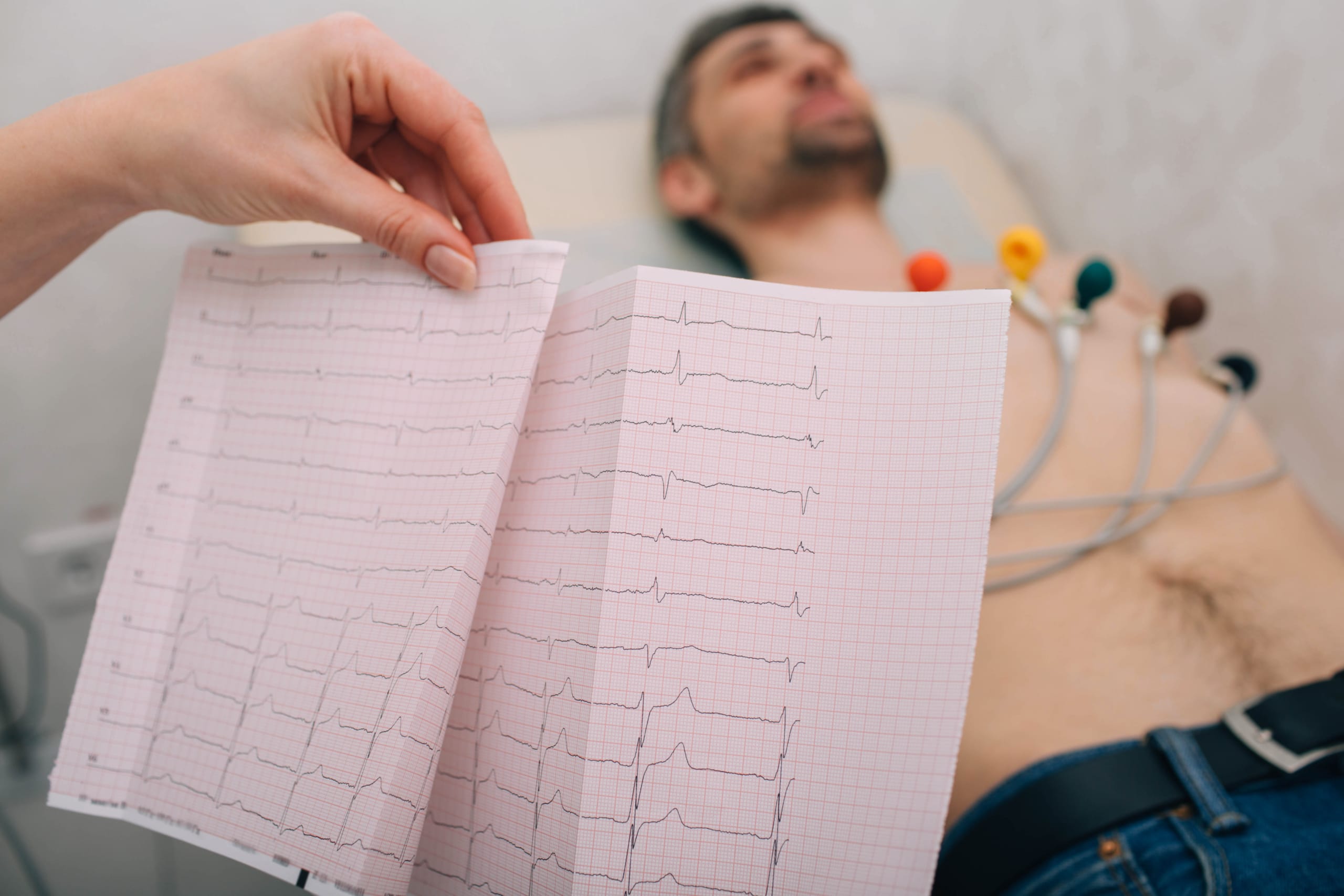 EKG: AV- blokk